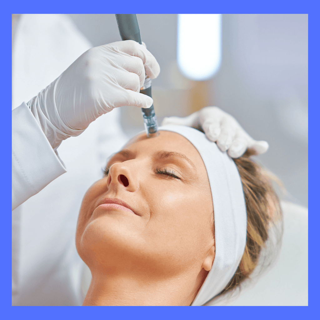 FACIAL SKIN NEEDLING ( with combination of PEELS )